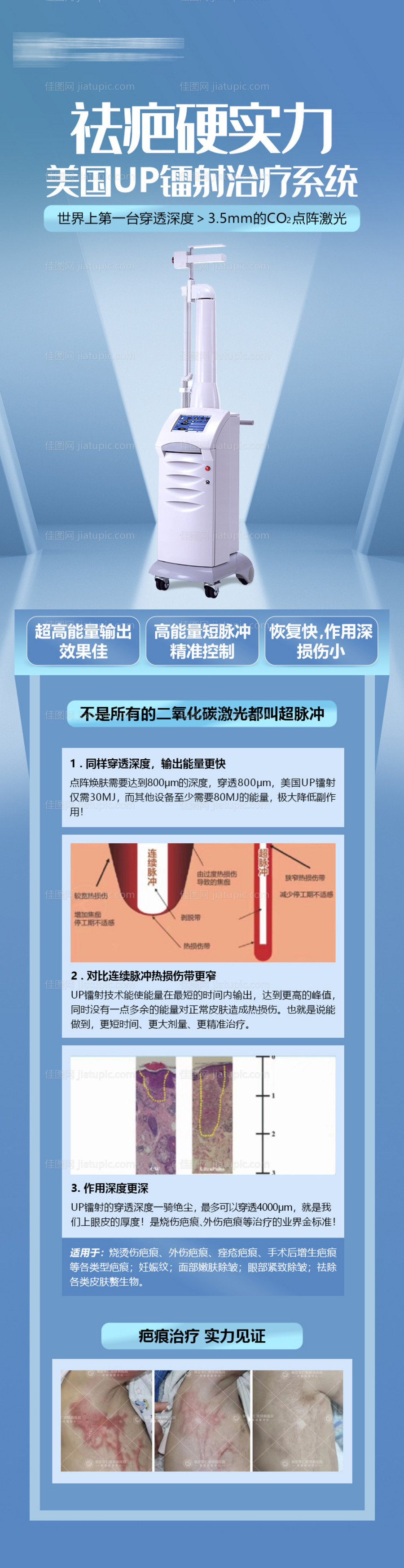 医美整形美容祛疤仪器海报长图-源文件